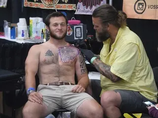 Echipament pentru îndepărtarea tatuajelor cu laser